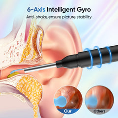 OHYAPI silicone ear covers enable hygienic, replaceable protection during cleaning