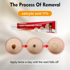 OJIOG wart remover gel absorbing into skin during application