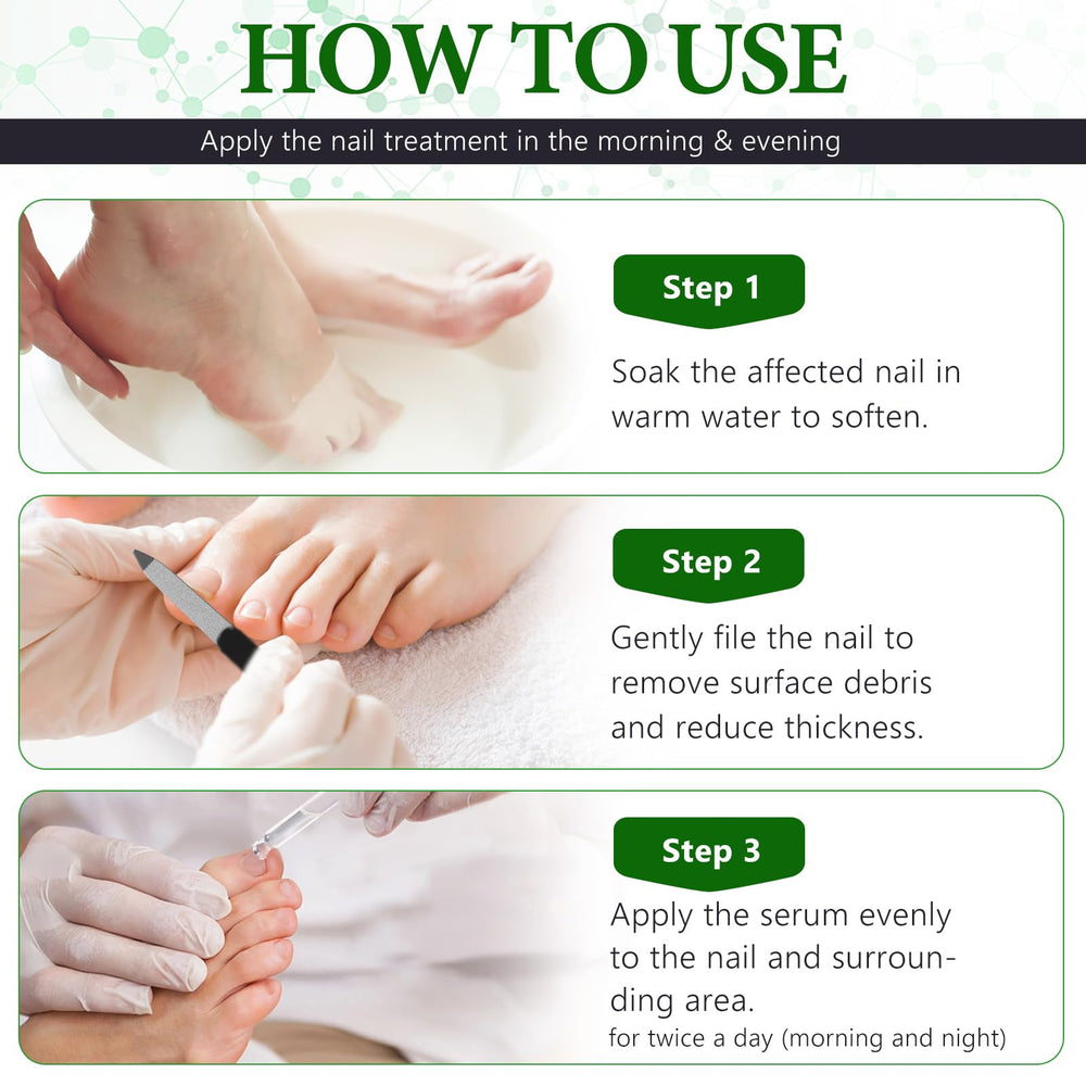 OMZOK cuticle nourishing treatment hydrates skin around nails for healthier look.