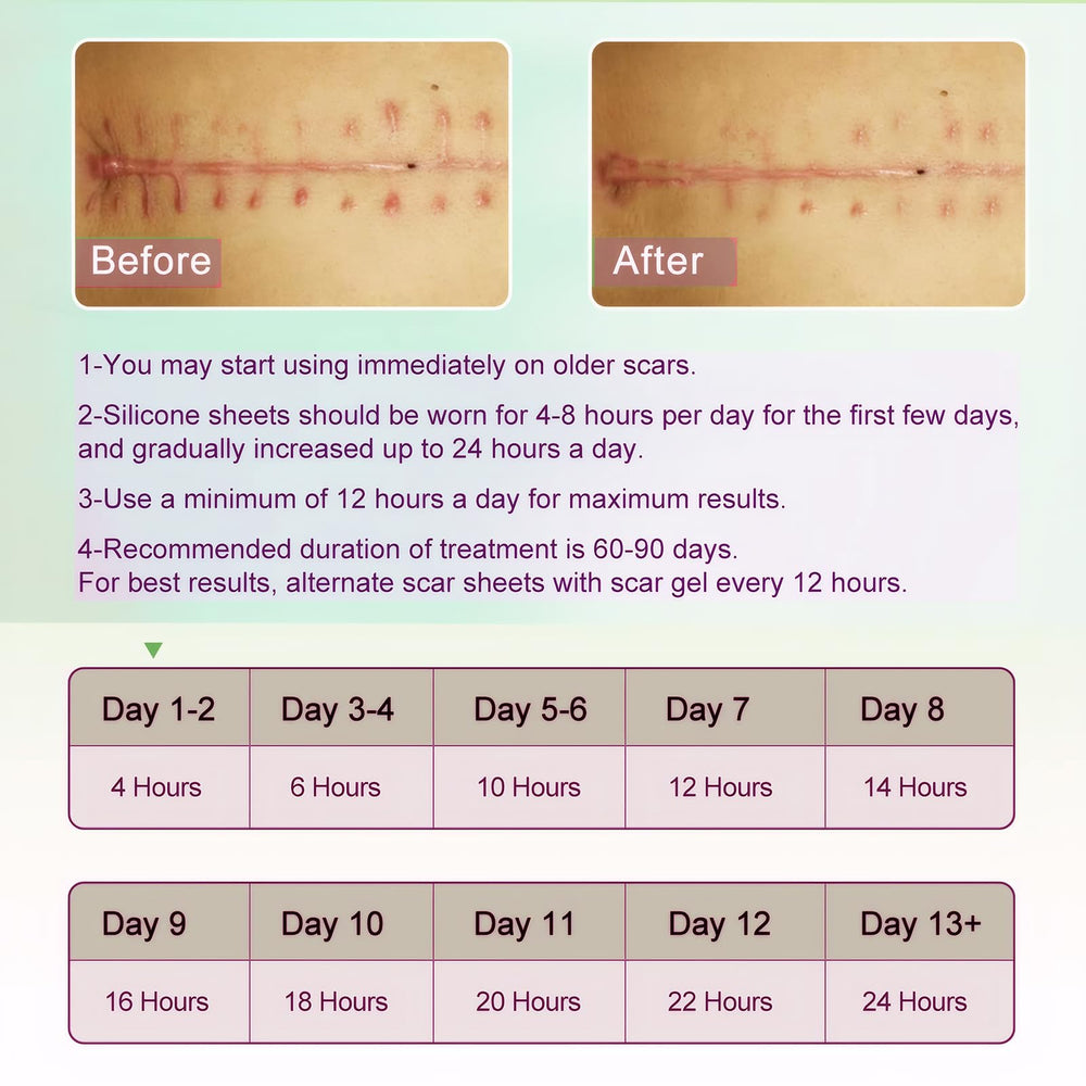 ONE1X silicone scar sheets cut to size for scar shaping