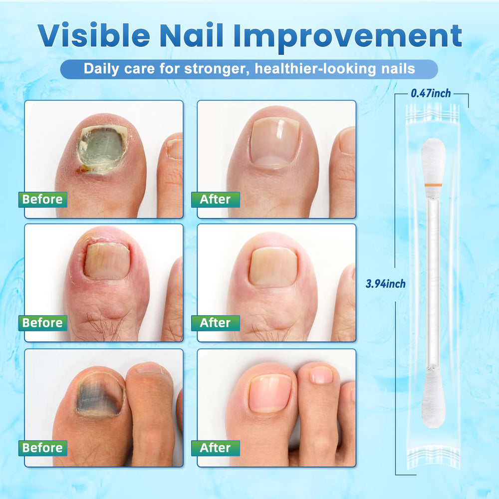 ONIADBA precision nail-bed application targets affected area.
