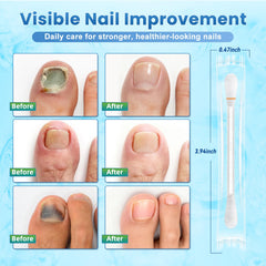 ONIADBA precision nail-bed application targets affected area.