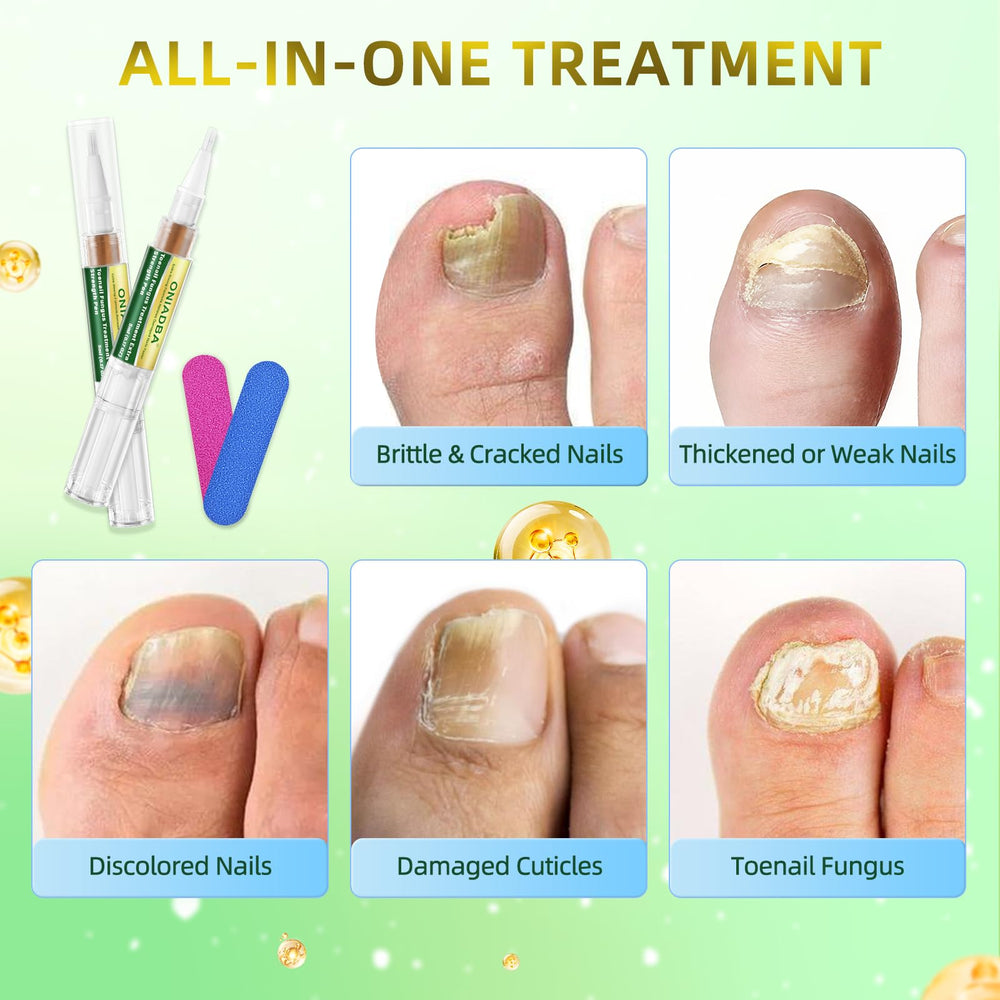 ONIADBA Toenail Fungus Pen enables precise under-nail coverage.