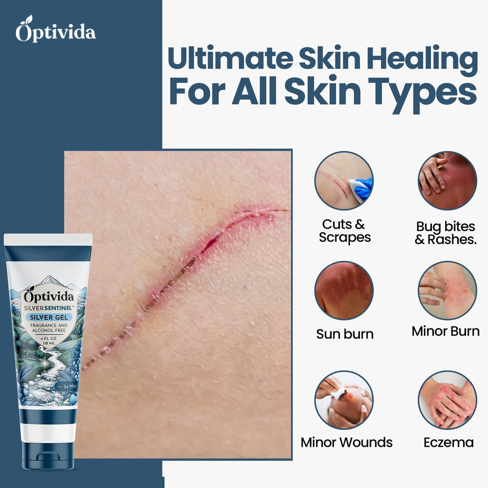 OPTIVIDA Colloidal Silver Gel being applied to skin for soothing relief.