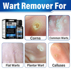 Step-by-step application image for OSNOIA Wart Remover Liquid