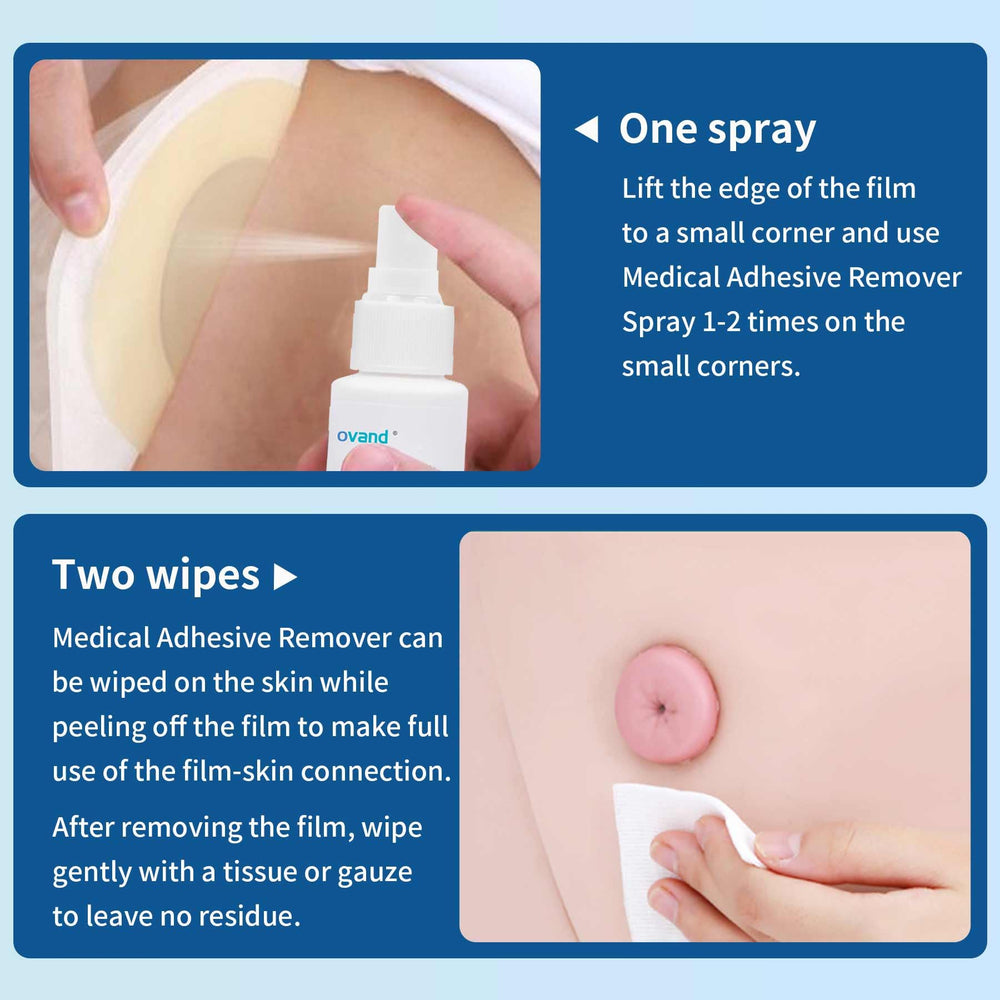 Ovand Adhesive Remover Spray nozzle dispensing on tape residue for quick prep