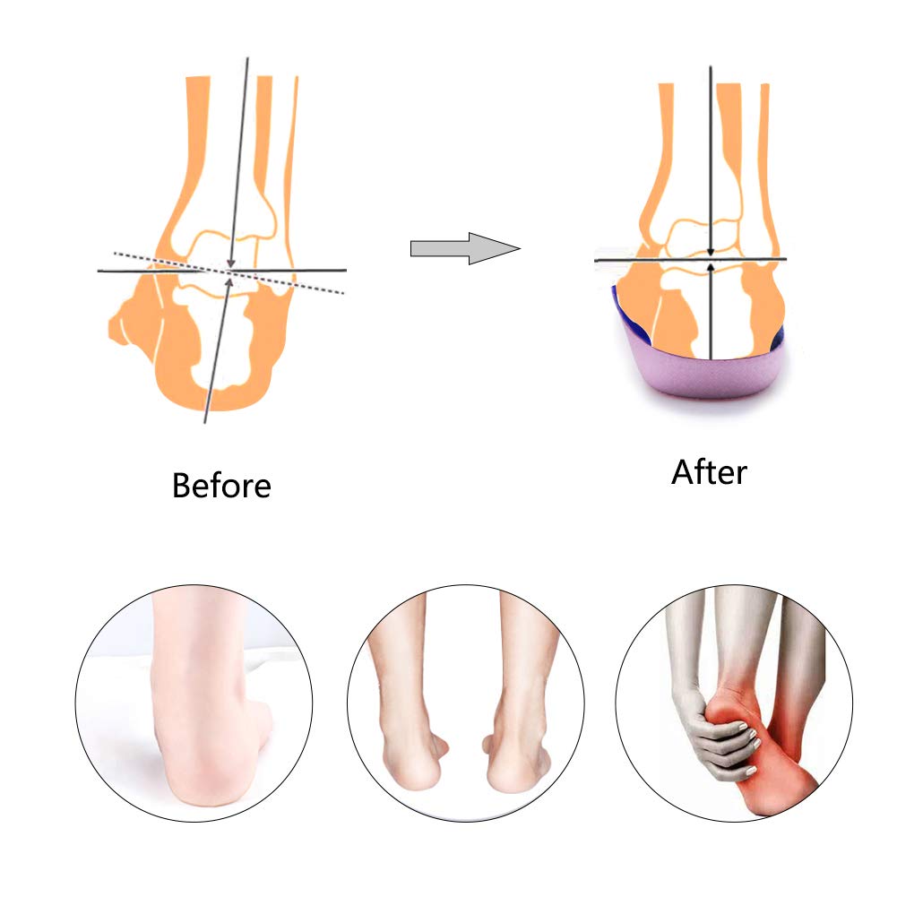 PCSsole three-quarter-length insoles fit most shoes for quick switching.