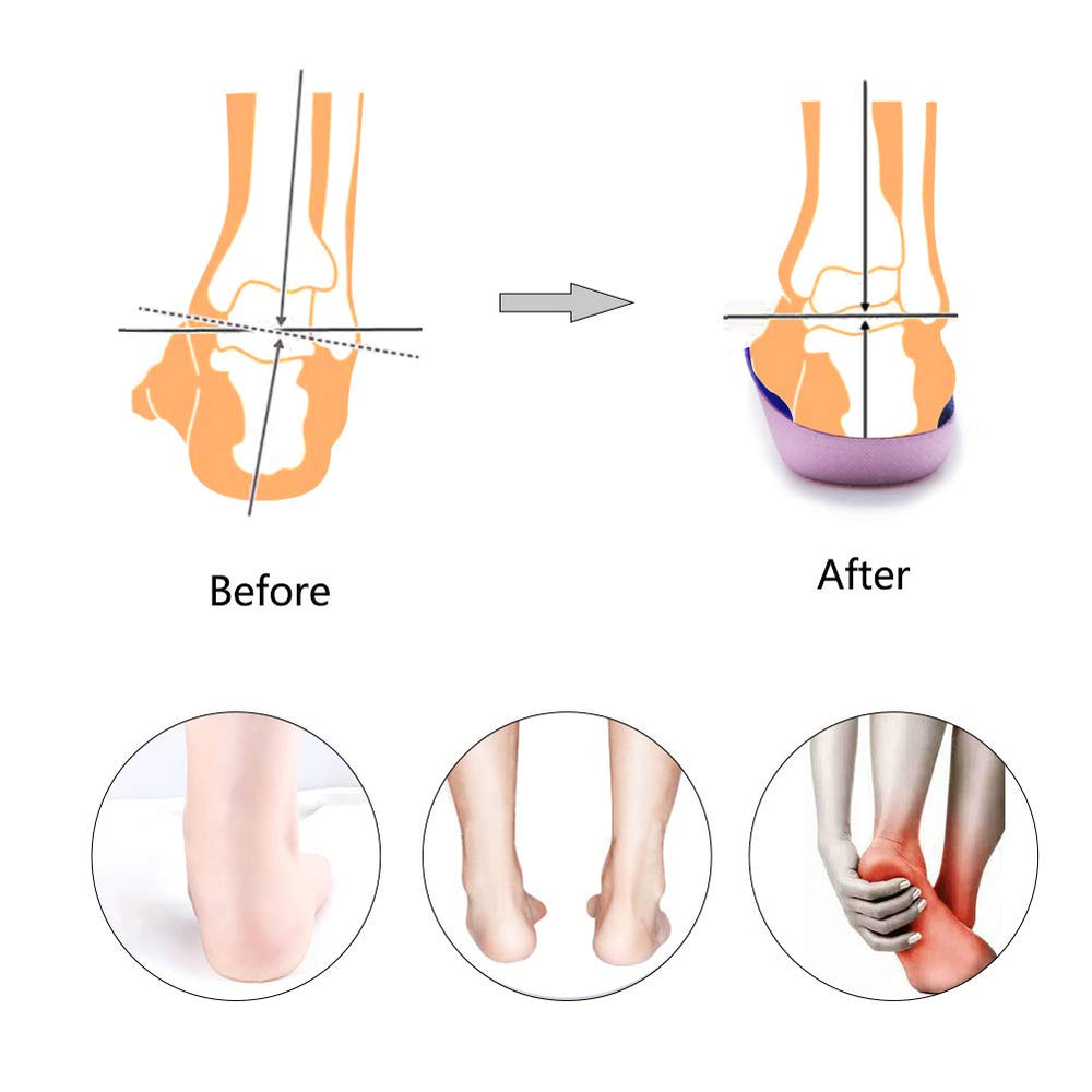 PCSsole three-quarter-length insoles fit most shoes for quick switching.