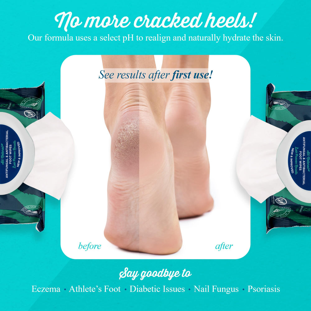 pHeet Foot Wipes apply on foot for quick refresh