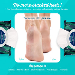 pHeet Foot Wipes apply on foot for quick refresh