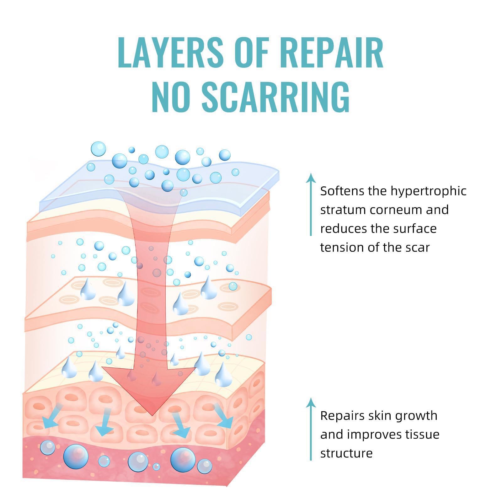 Pinnoocy scar gel on a healed scar area after surgery