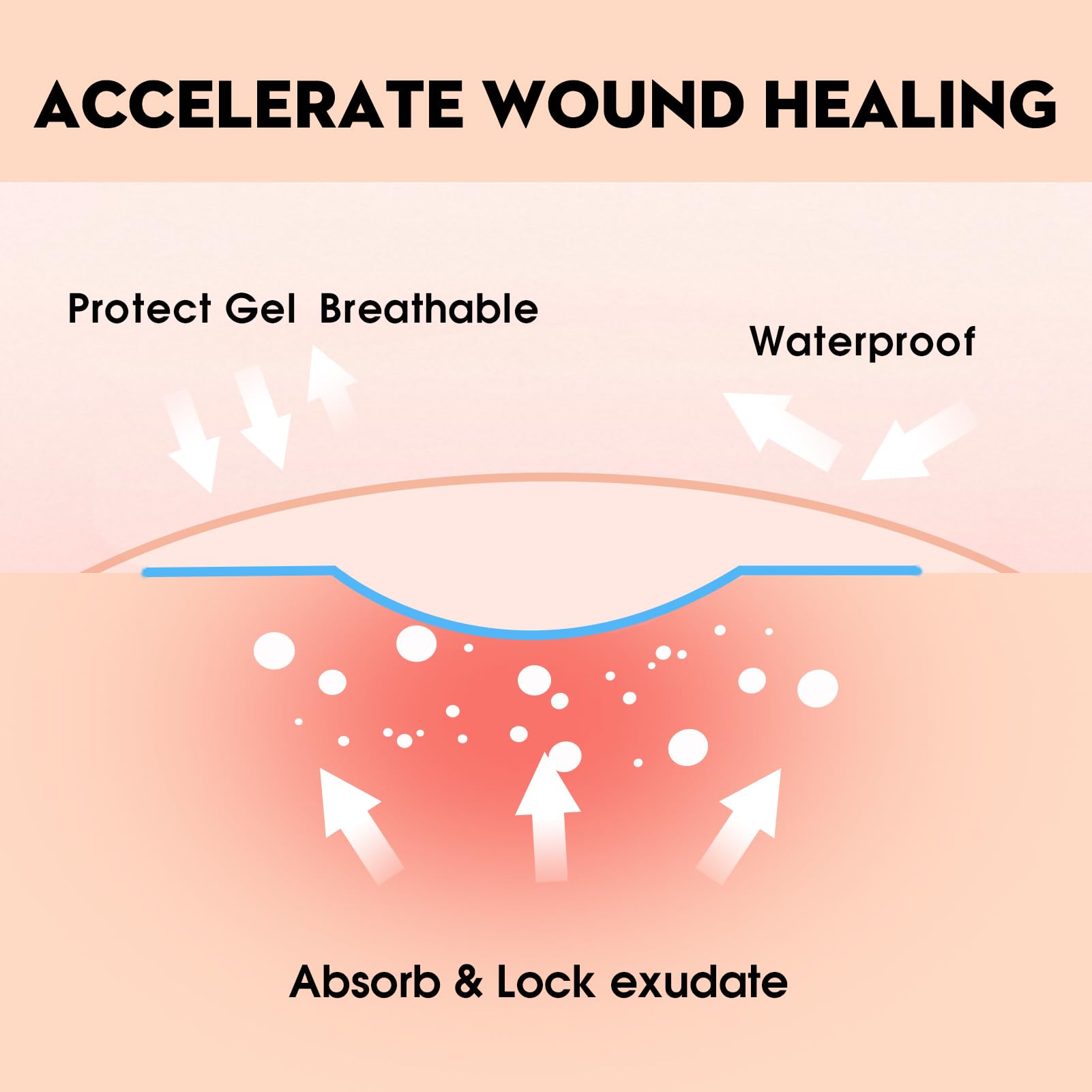 POLYNEW acne patch suitable for pimples with gentle adhesion