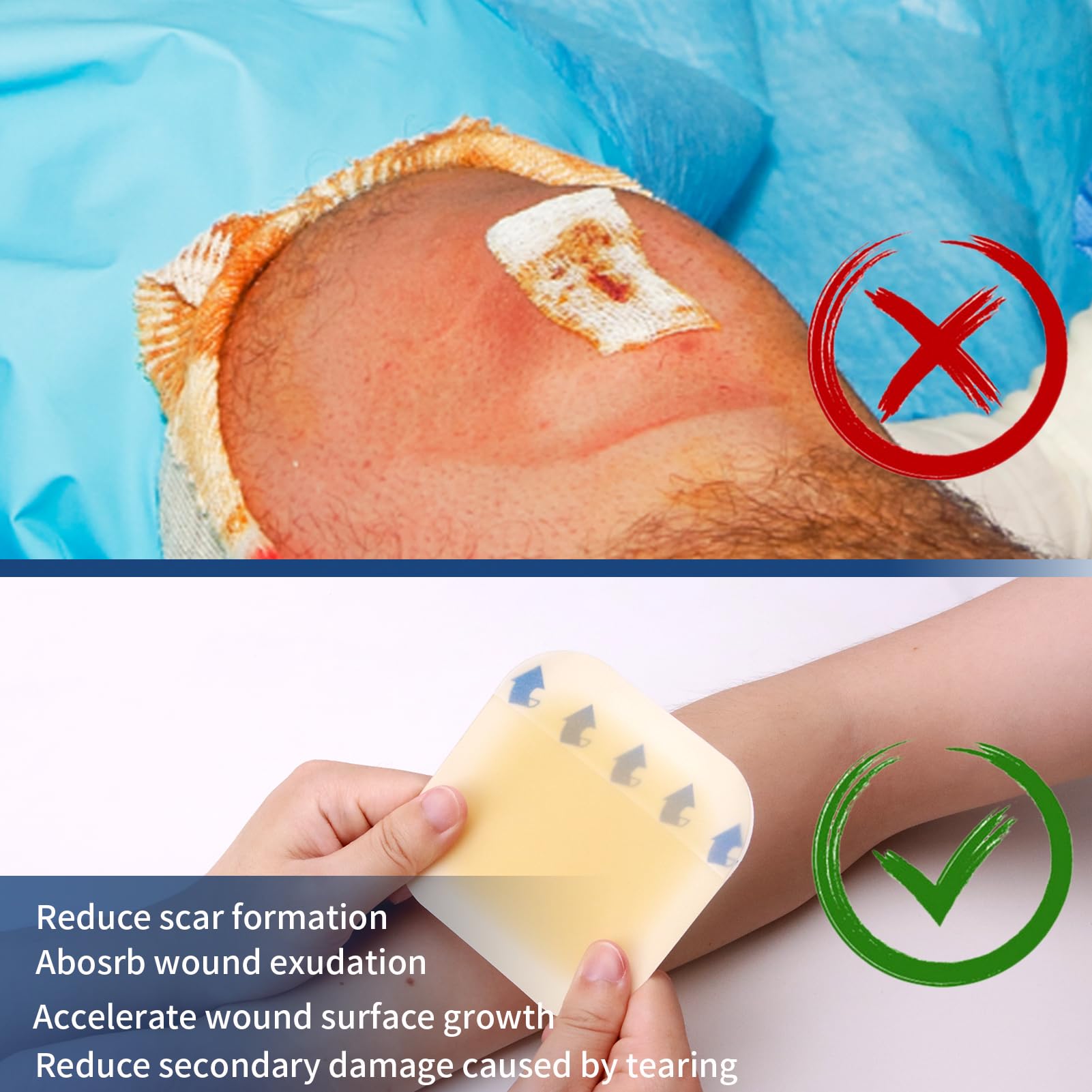 POLYNEW 10pcs box ready for home or clinic wound care
