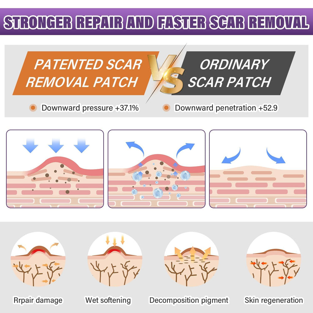 Psecici hospital-grade silicone sheet visuals for safe, gentle scar care.
