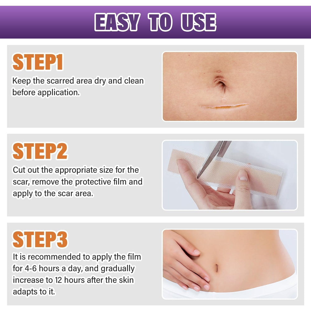 Psecici silicone scar removal roll helps discreetly manage post-surgery marks.