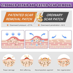 Psecici silicone scar sheets soft-breathable wear for 24 hours.