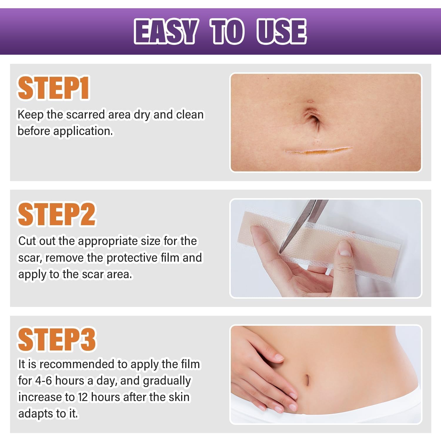 Psecici silicone scar strips for keloid-prone areas with gentle support.