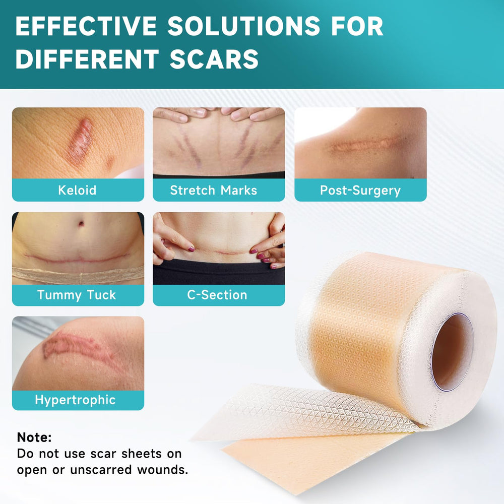 Pumkot silicone scar sheets on skin closeup, ultra-thin comfort against daily movement