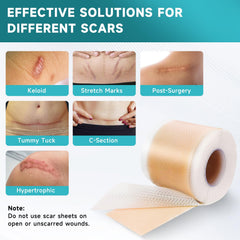 Pumkot silicone scar sheets on skin closeup, ultra-thin comfort against daily movement