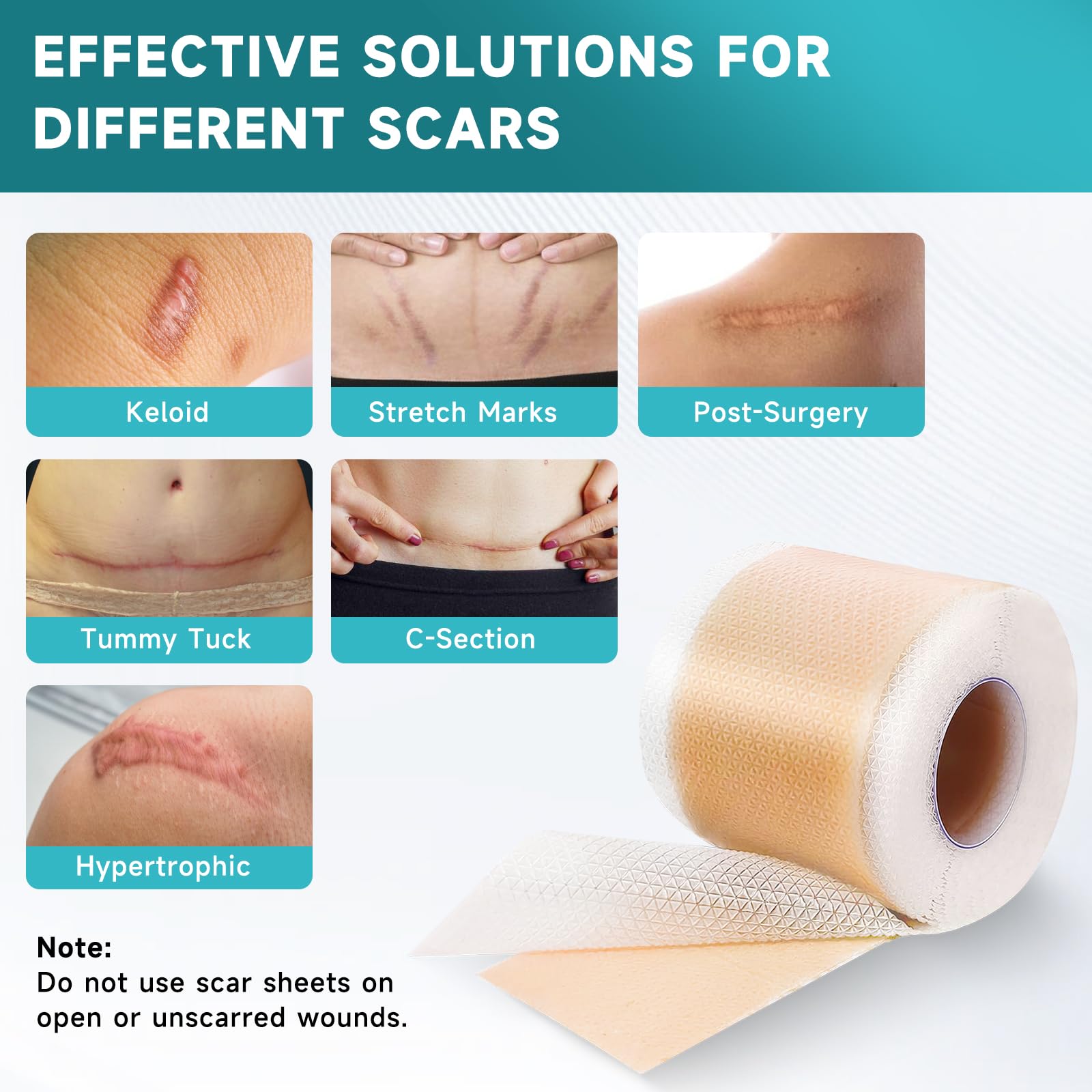 Pumkot silicone scar sheets soft fabric resting against the skin for comfort.