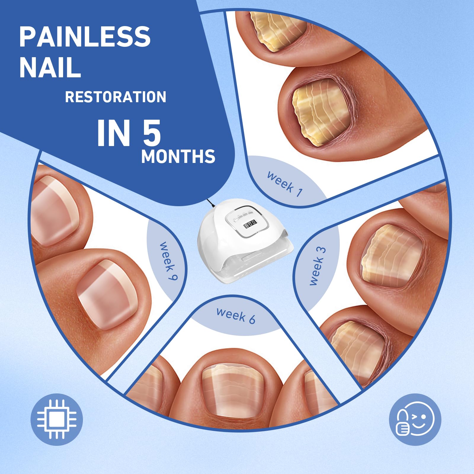 PUPCA nail fungus device timer settings for quick, personalized sessions