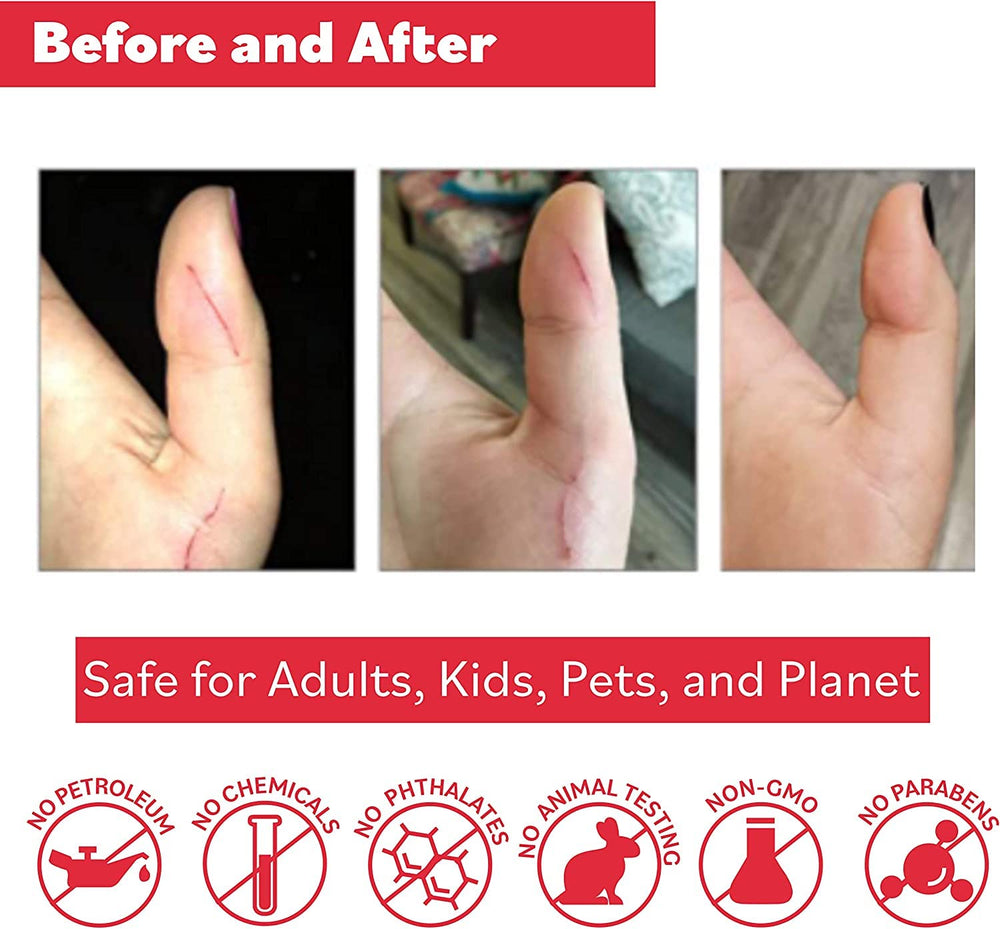 Label on Puremedy Original Healing Ointment highlights all-natural ingredients and safe formulation.