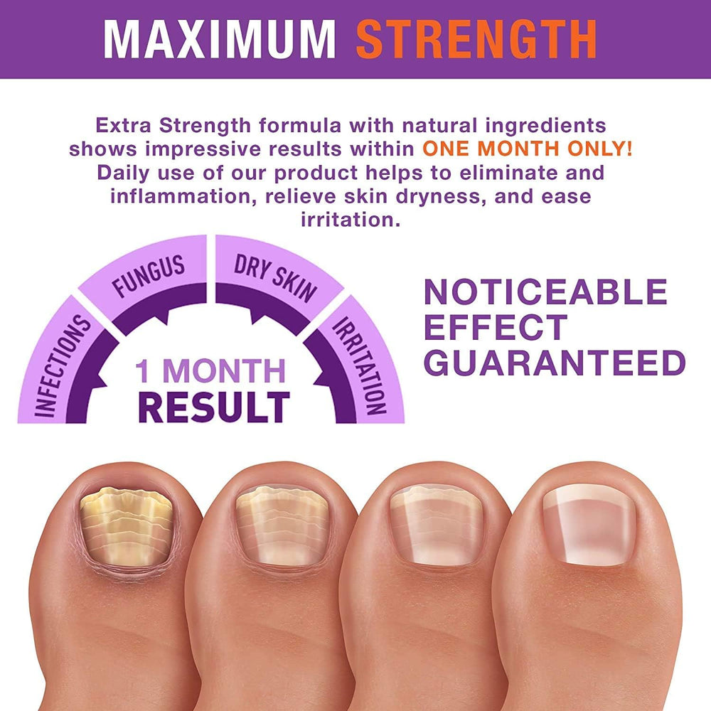PureSkin before-after nails showing gradual improvement.