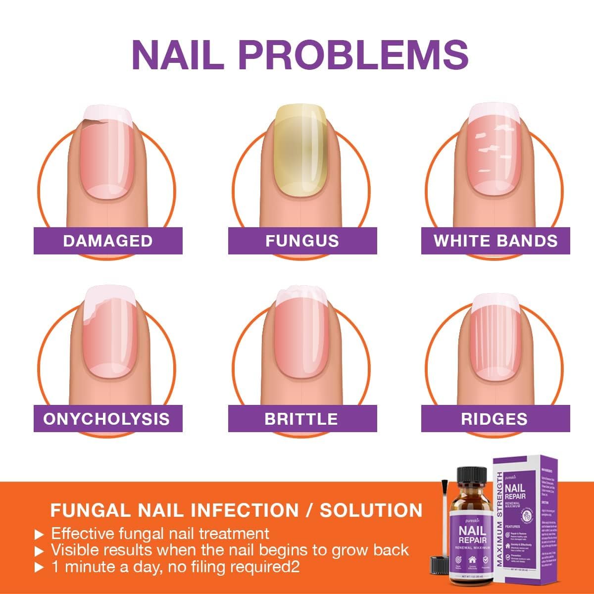PureSkin nail file in use preparing the nail for treatment.