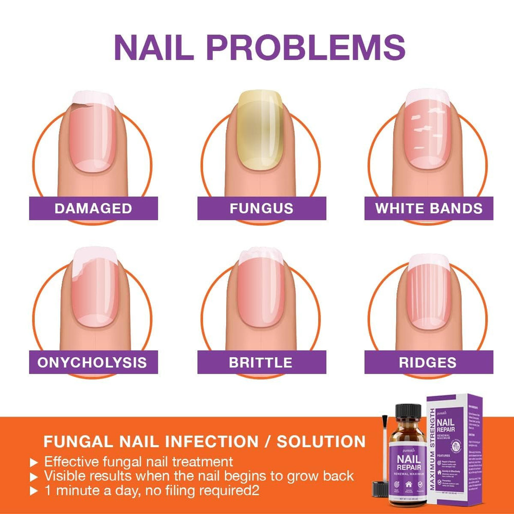 PureSkin nail file in use preparing the nail for treatment.