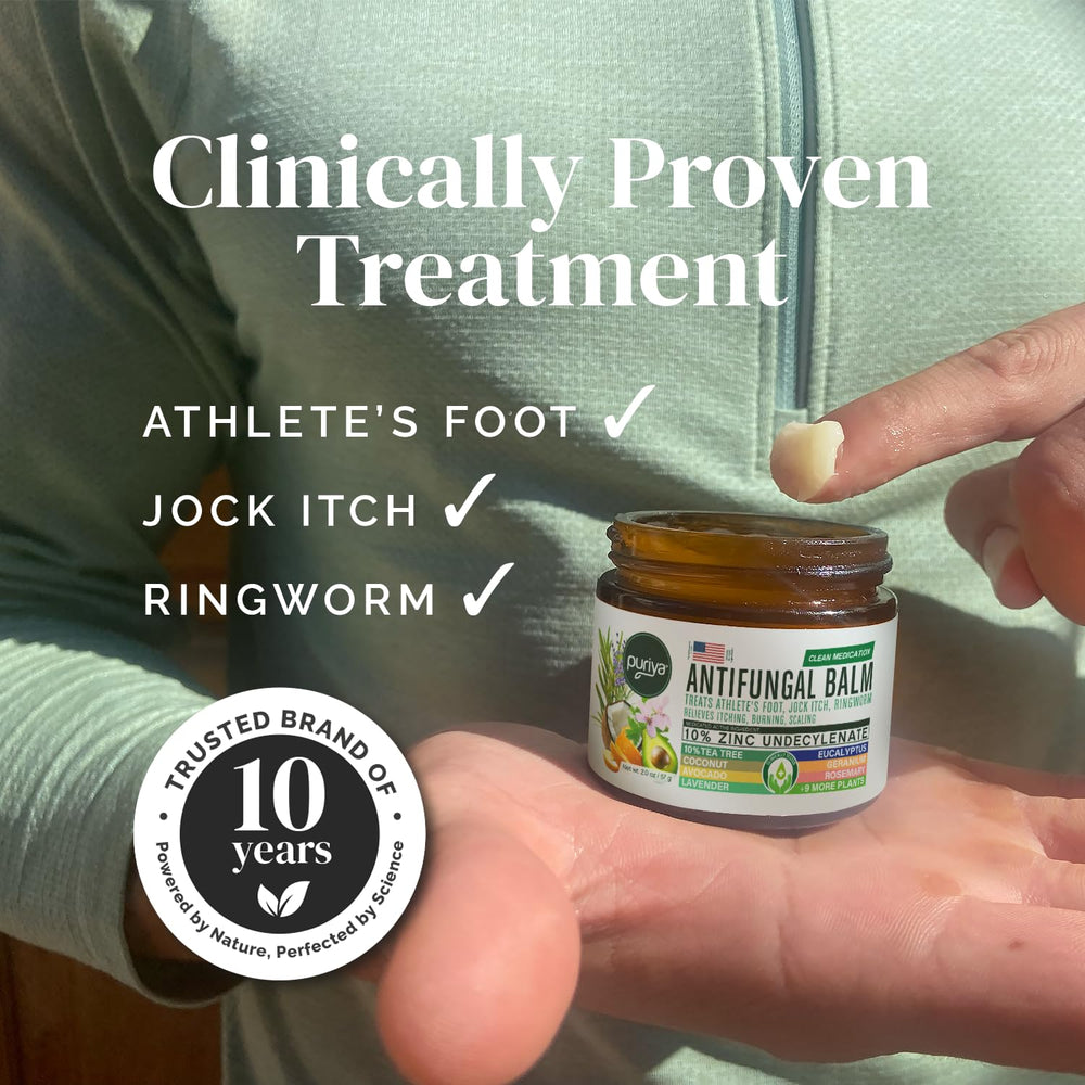 Puriya antifungal cream application on skin demonstrates easy itch relief.