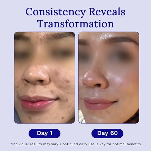 Applying RejuvaSil to a scar area to support scar care.