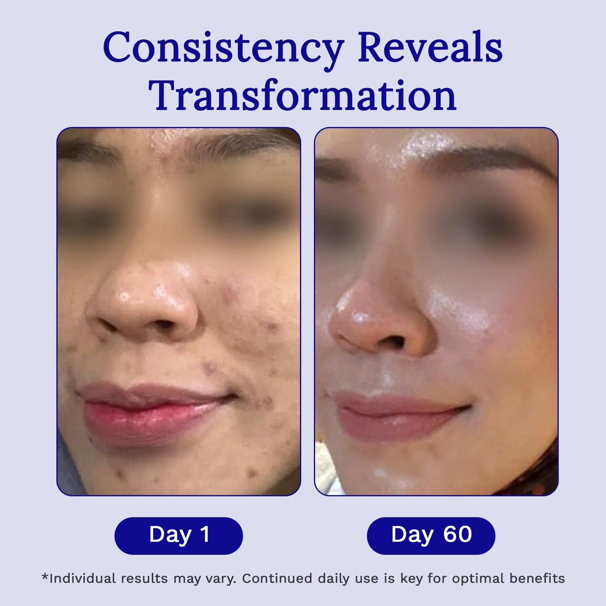 RejuvaSil's unique formula dries quickly, avoiding stickiness.