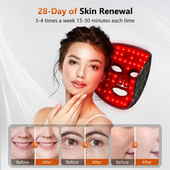 RELEXNOW LED face mask with remote control for easy timed sessions