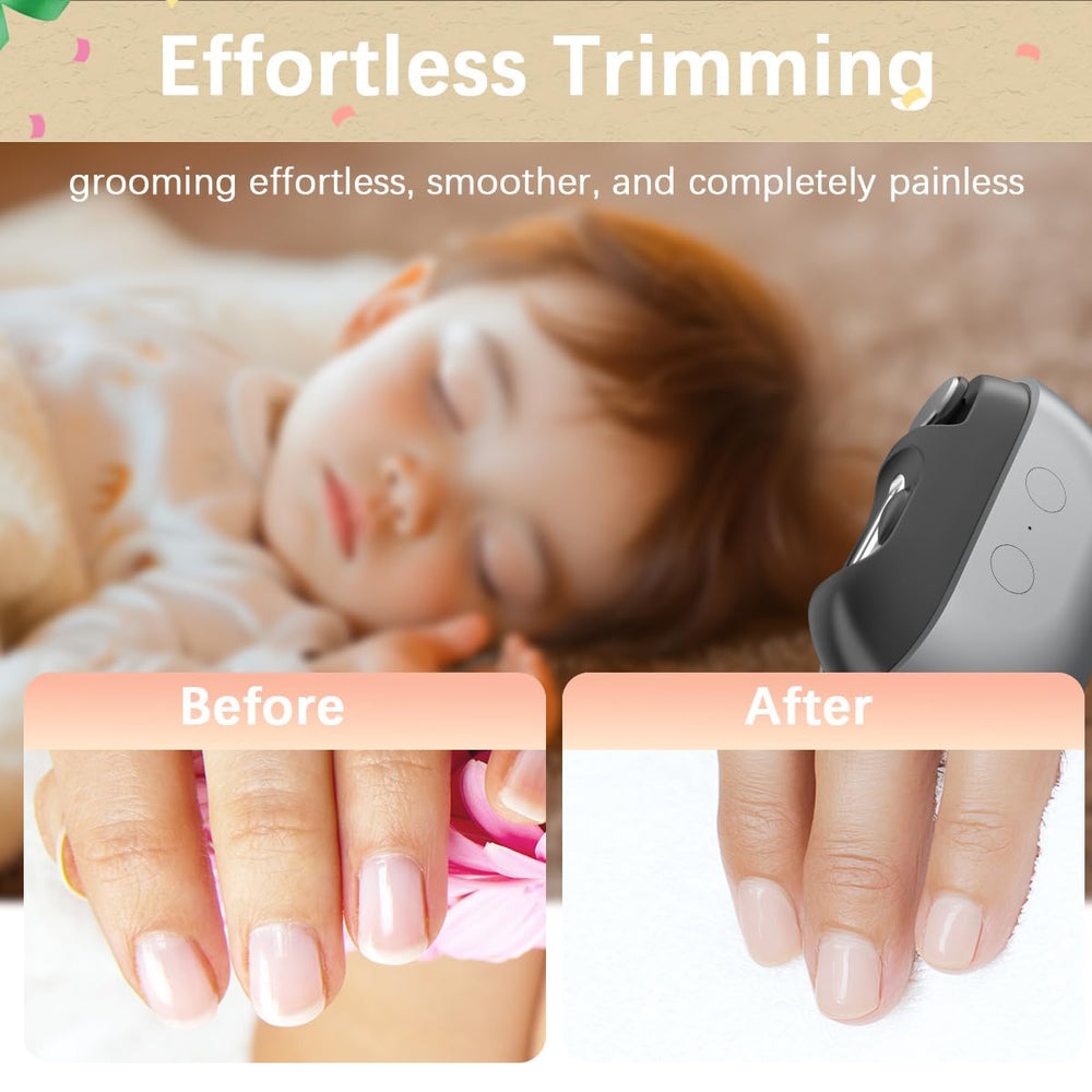 RIMOL 3-in-1 nail trimmer polisher for smooth, salon-like nails.