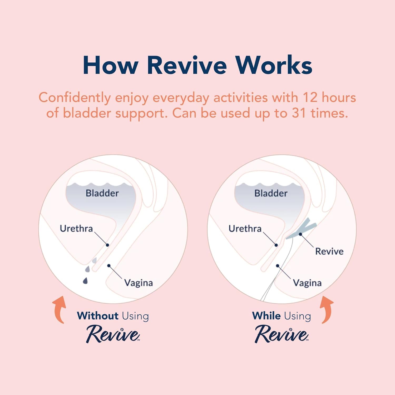 RINOVUM Revive one-size-fit design for most users.