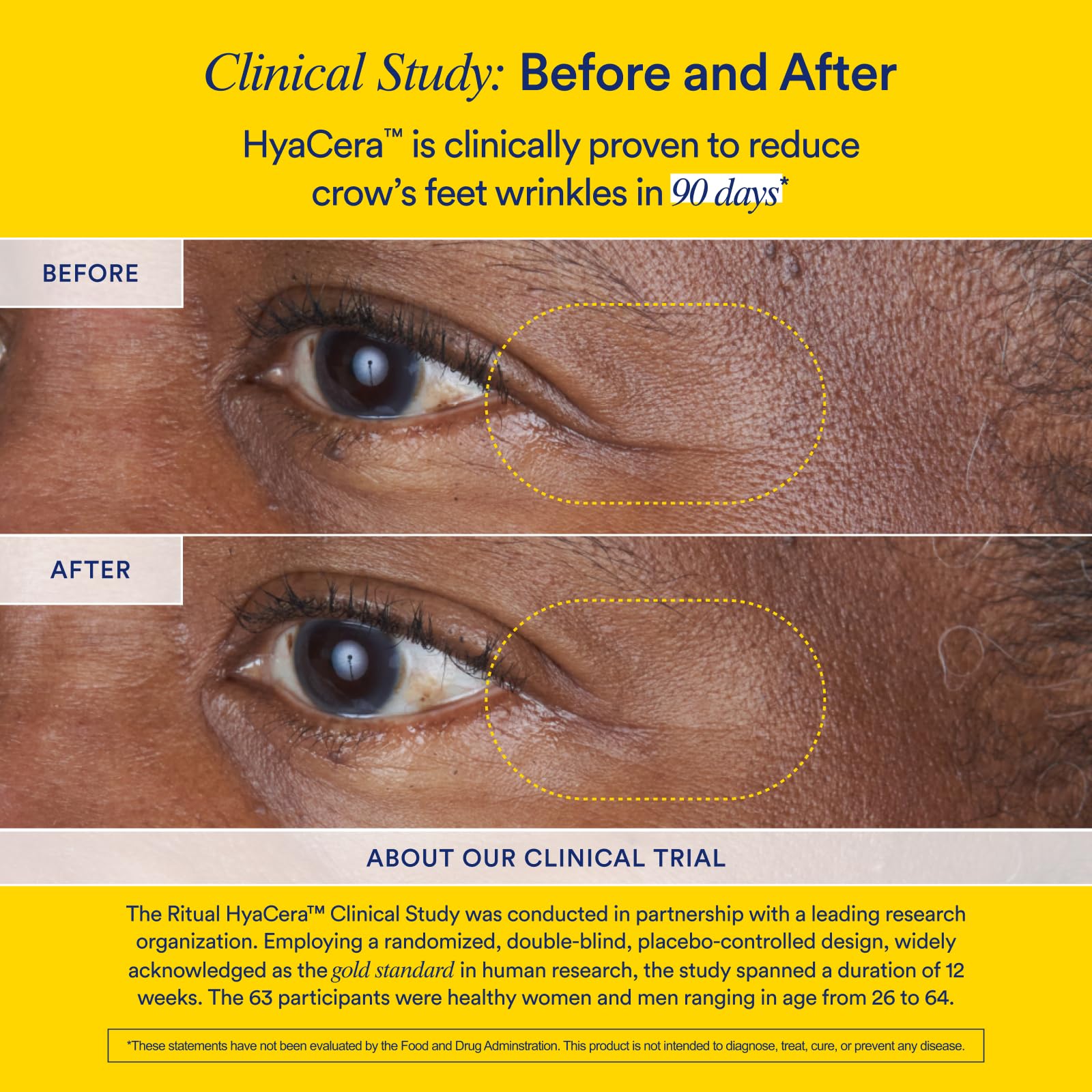 Ritual HyaCera Hyabest ingredient badge highlights key active components.