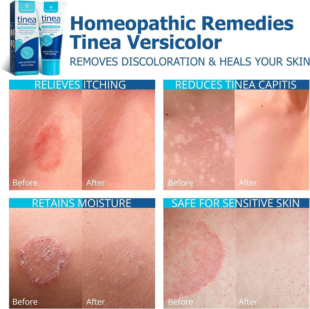 Roycederm herbal extracts visual cue for gentle ingredients