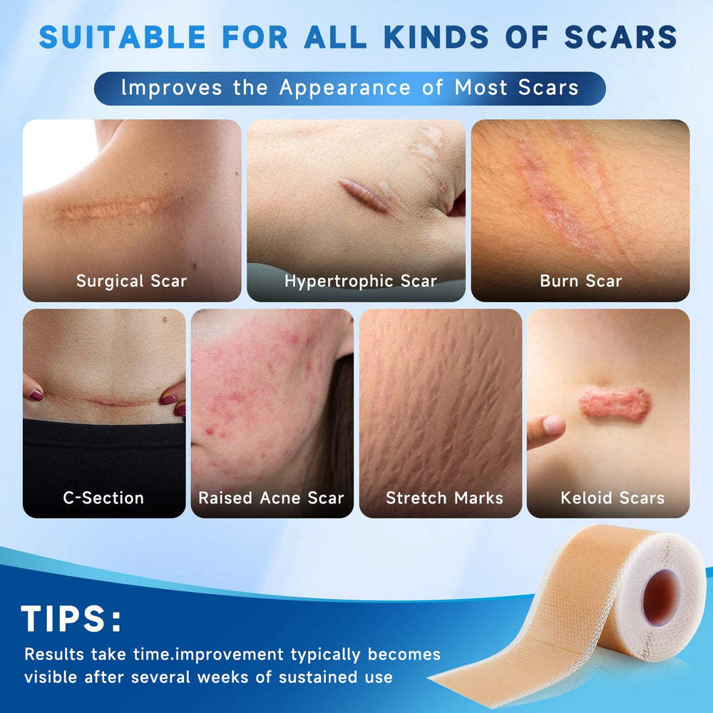 Rvlaim silicone scar sheets surgical scar, texture-focused application on post-surgical skin