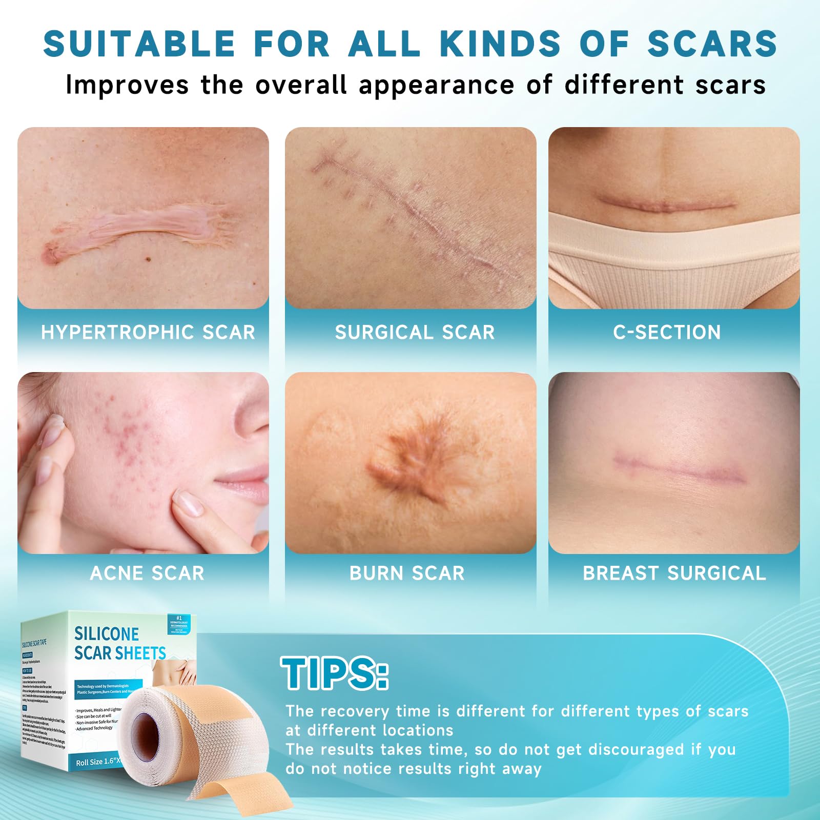Rvlaim tearable edges let you quickly size any scar.