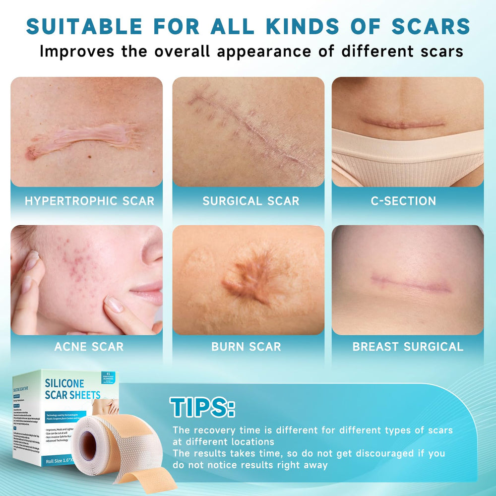Rvlaim tearable edges let you quickly size any scar.
