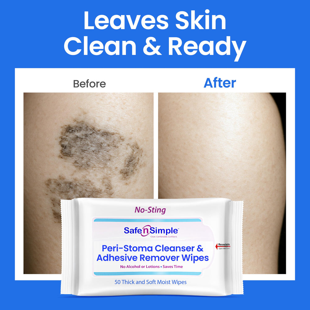 Large 5x7 inch wipes cover bigger areas for bandages and dressings