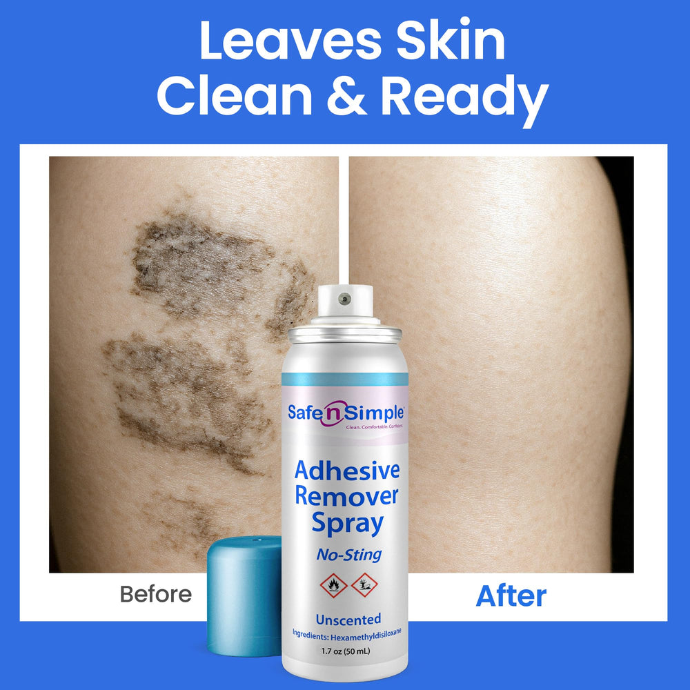 Dexterity-friendly Safe n' Simple spray aids caregivers with limited grip