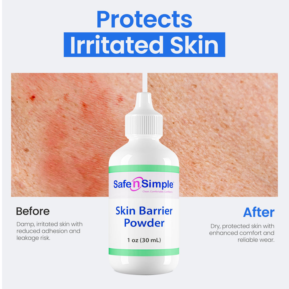 Safe n' Simple skin-care-powder-application aids protective crust and comfort