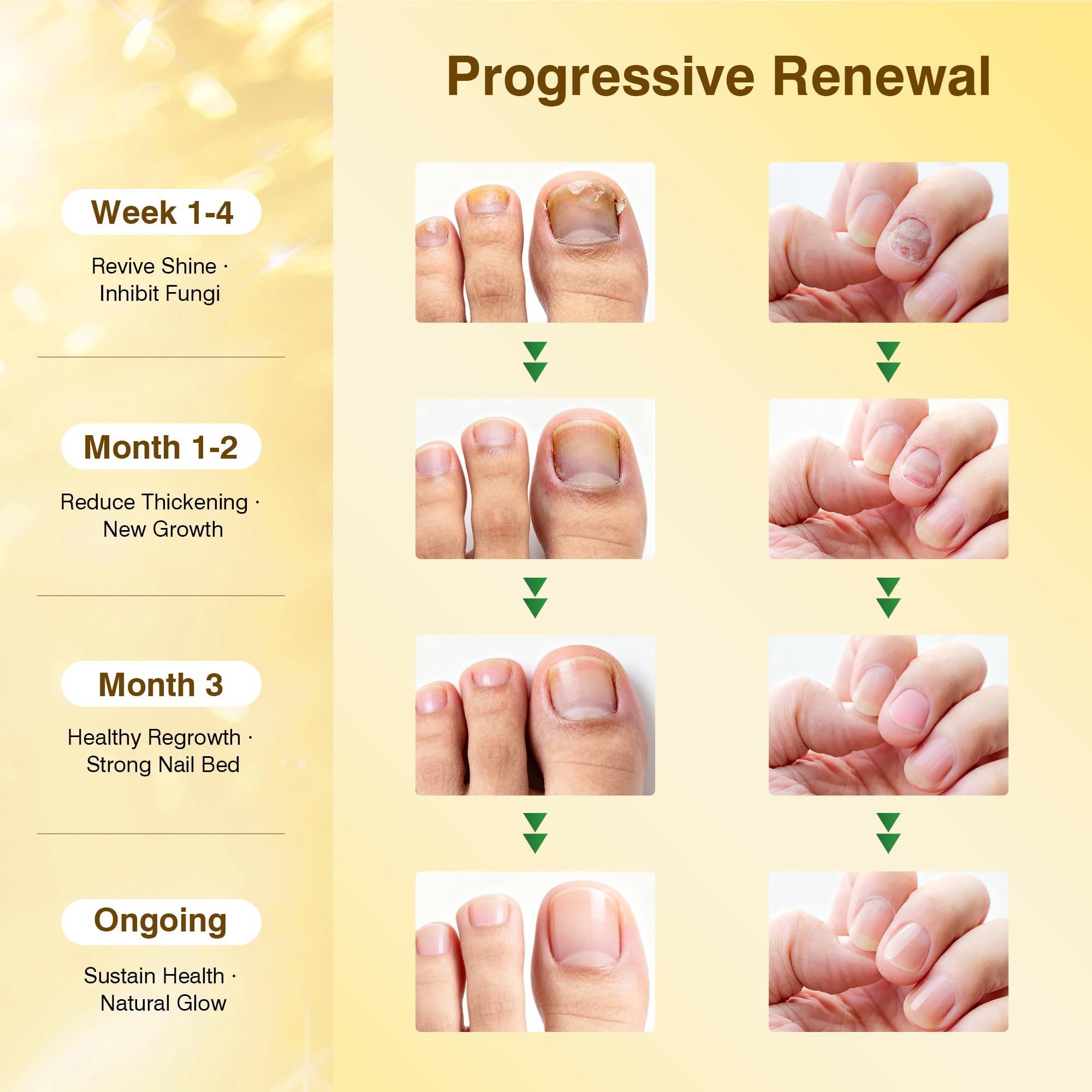 SafeFight pen applied to the affected nail area for treatment.