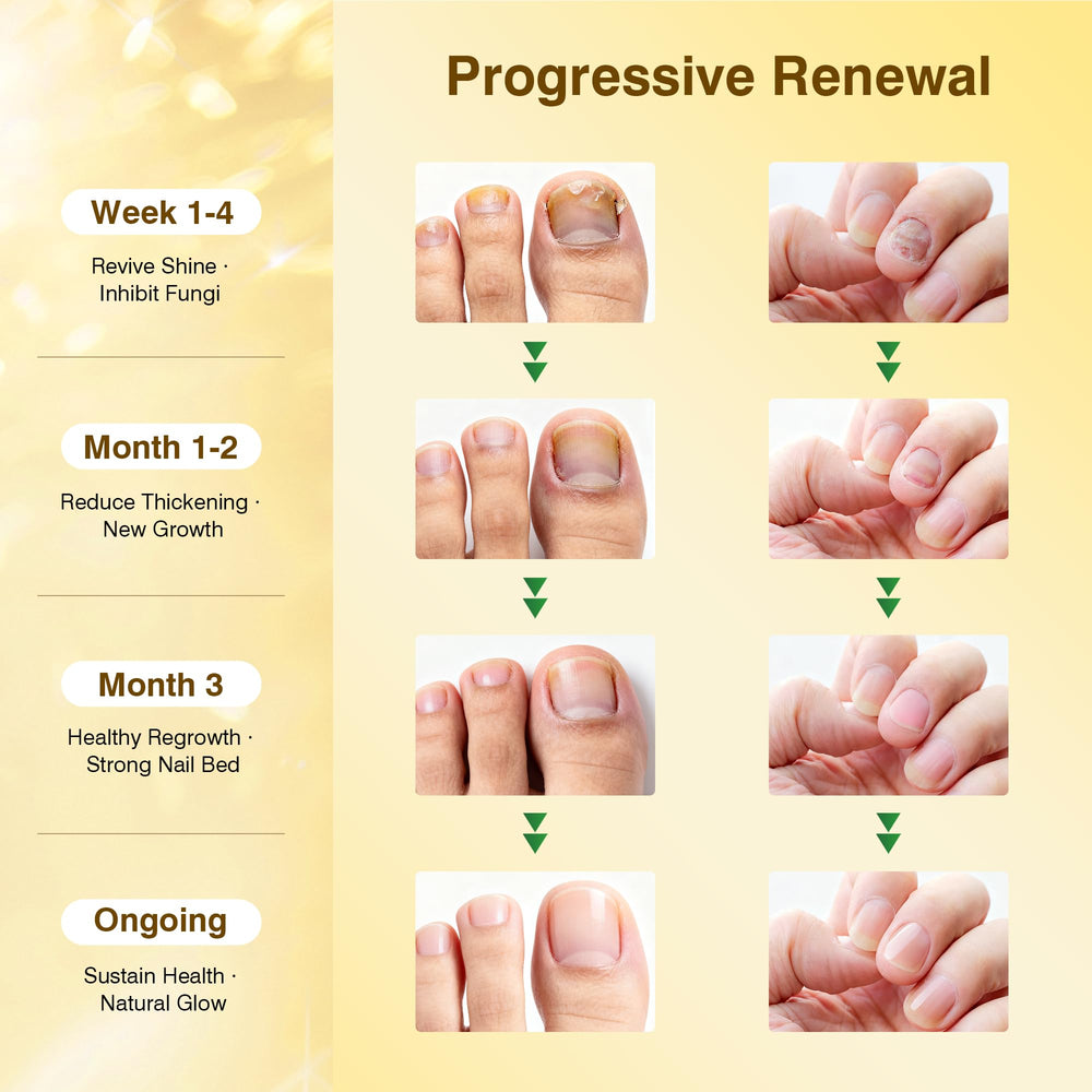 SafeFight pen applied to the affected nail area for treatment.