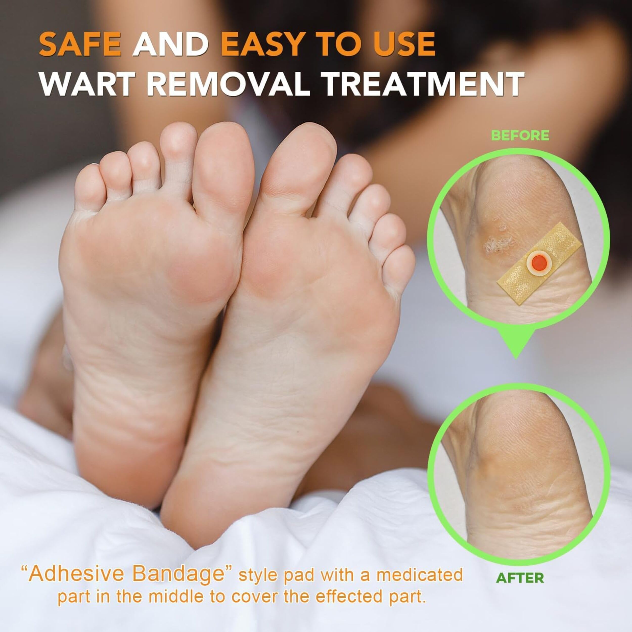 Samsali plantar wart pads designed for convenient home use