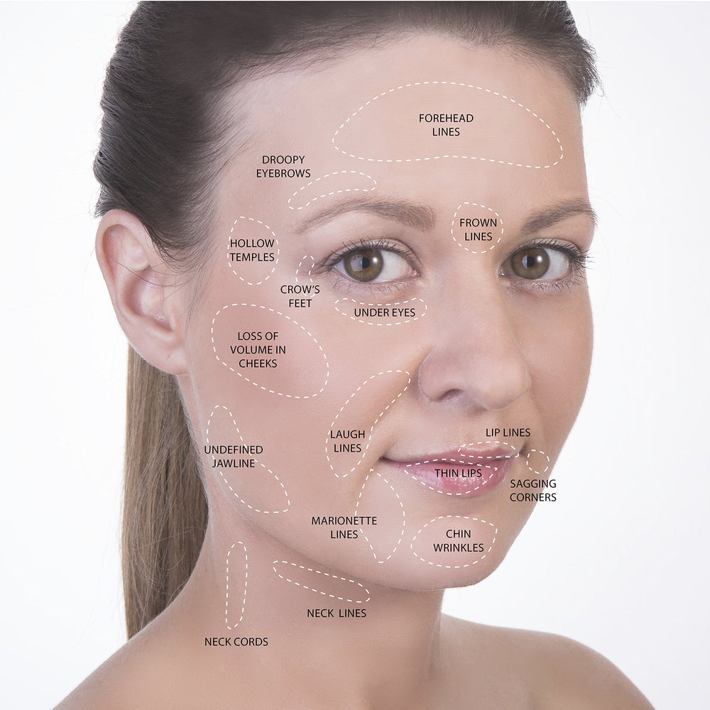 SanDine Silky Skin face cupping set for facial contouring