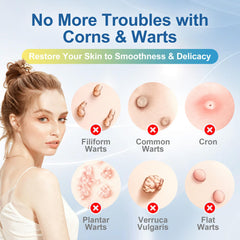 Sanuscode wart remover pads with self-adhesive back for secure wear