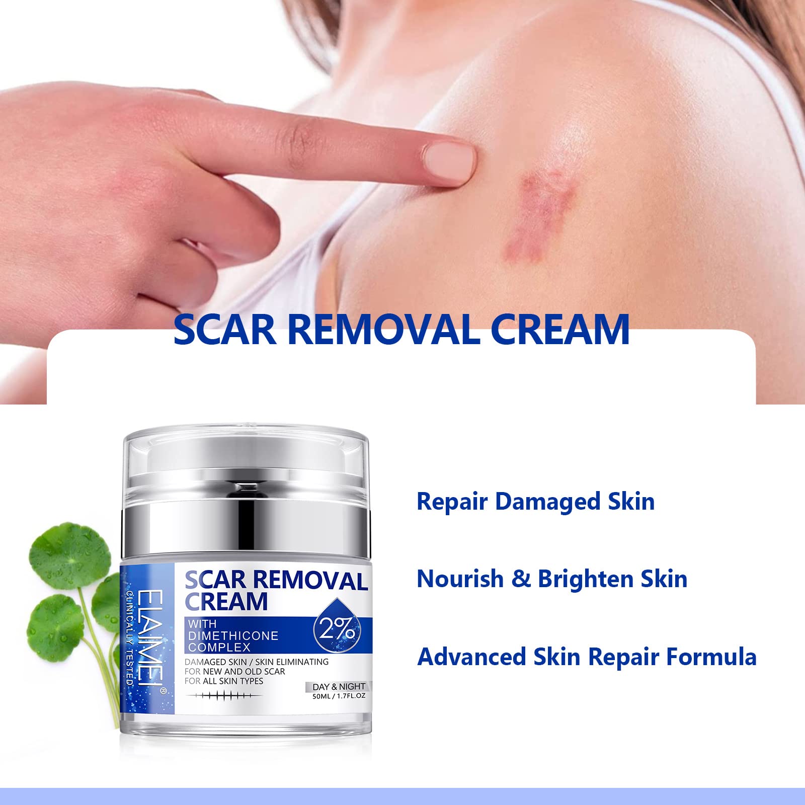 SBHEANGBA Scar Cream natural ingredients promote gentle scar renewal