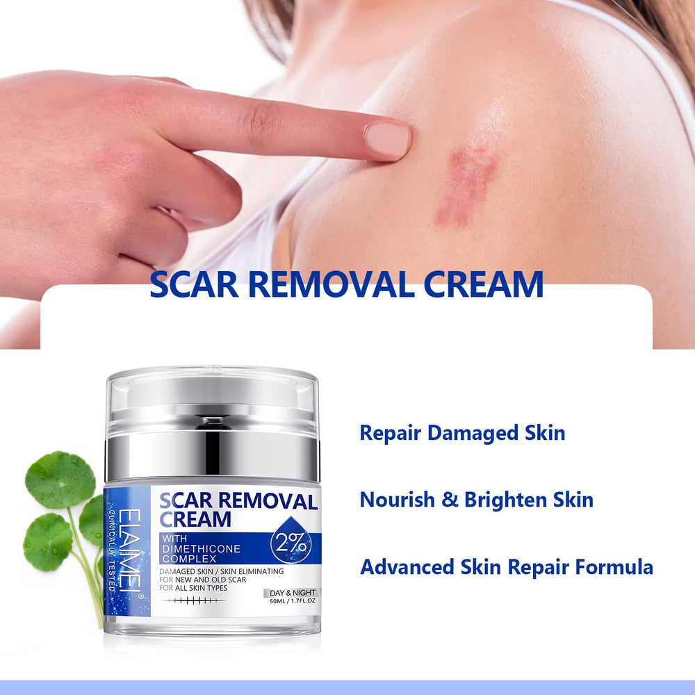 SBHEANGBA Scar Cream natural ingredients promote gentle scar renewal